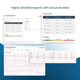 Sunfox Spandan Pro ABS White Portable ECG Heart Rate Monitor with Li-ion Battery, GP-O34F-YYQB image 4