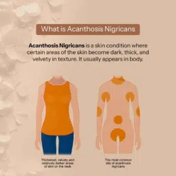 Glopetra 100ml Skin Tone Perfecting Cream, GLP016 image 3