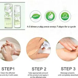 buziventures Eczemaron Anti Fungal Cream for Treating Severe Foot Fungus_MZ78 image 2