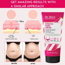 dr.rivo professional Stretch Mark Cream for Belly, Breasts & Hips | Pregnancy Safe Intimate Cream image 4