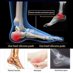 nappwe Silicone Gel Heel Protector For Pain Relief, Swelling, Foot Care Support Heel Support image 2