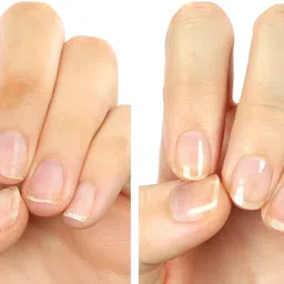 reimichi nail paint remover for all girls Moistened Nail Paint Remover image 3