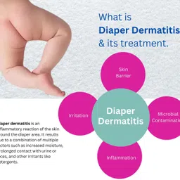 MATEO Baby Rashfree cream | Rash Relief Cream Healing & Nourishing Diaper Cream, 4x image 5