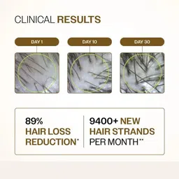 qtpie Hair Growth Serum | Redensyl + Anagain + Baicapil & Rosemary (30 ml) image 4