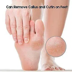 rustic rituals Lava Pumice Stone for Foot Callus Knees and Elbow | Pedicure- Callus Remover for Feet & Hands - Pedicure Tool Exfoliation to remove dead skin image 3