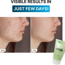 med manor Acnerex Face Wash image 5