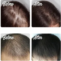 gulglow99 Hair Regrowth Spray for Hair AR123 medium Hair Volumizer spray image 3