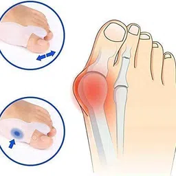 suefor Silicone Foot Care Gel Bunion Protector Toe Separators Straightener Spreader image 2