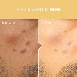 THE MAN COMPANY Vitamin C Face serum with 40% Hyaluronic Acid for Brightening and AntiAging image 4