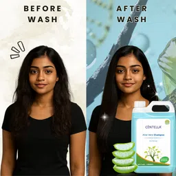 centella Aloe Vera |Shampoo|Natural & Herbal | Anti-Dandruff | Hair Fall Control shampoo image 4