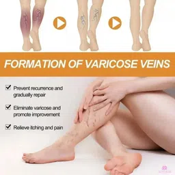aeyurbs Varicose Vein Relief Spray | That Restores Natural Balance Liquid image 2