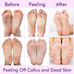inohiv Foot Peeling Mask for Dead Skin Removal image 4