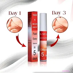 glammia Tags And Moles Remover | safe and natural formula image 4