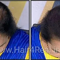 Hair4Real Hair Building Fibers, Dark Brown, 12 g image 5