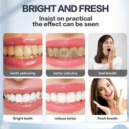 skookum Deeply Clean Gums and Cavity Protection Teeth Whitening Foam Teeth Whitening Kit image 4