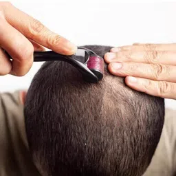 anatomicals DermaCraft Titanium Derma Roller for Skin Glow image 4