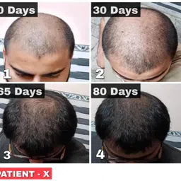 fidore Plant-Based Biotin Boost – Anti-Greying, Muscle & Heart Support image 4