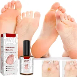 Berry Bliss Foot Corn Removal Gel – Fast-Acting Corn and Callus Remover for Hard Skin, Gentle Formula for Softening and Removing Corns and Calluses, Easy-to-Use Gel for Feet Care image 2