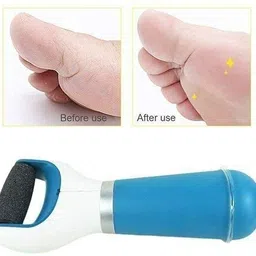 pkk traders PROFESSIONAL QUALITY FOR SOFT & SMOOTH FEET PEDI ROLLER image 2