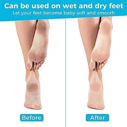 glow first Leg, Heel & Foot Scrubber for Dead Skin - Very Sharp & Big (11 * 3 inch) - Pedicure & Feet Scrub Tools, Foot Scraper Cleaner & Filer, Callus Remover For Cracked Heels (Metal) image 4