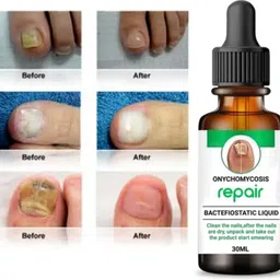 New Nail Oil - For Nail Growth | Long, Strong Nail | Repair Break Nail & Cuticle Clear-image-11