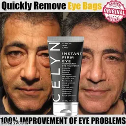 famire Celyn instant firmx eye tightener, eye tightening cream instant, fade fine lines image 1