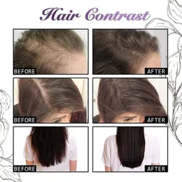 arcanuy NEW Rosemary Water for Hair Growth, Rose Mary Water Spray Rose Marry image 3