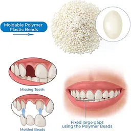 qorelya Temporary Tooth Replacement Kit Simple Dental Repair at Home Teeth Whitening Liquid image 3