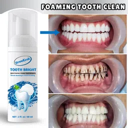 growkesh Teeth Whitening Foam With Mint Flavour Tightens Gum,Fight Germs Teeth Whitening Kit-picture-47