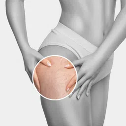 fraileno Stretch Marks Oil, Reduce Scar Before & After Pregnancy image 4