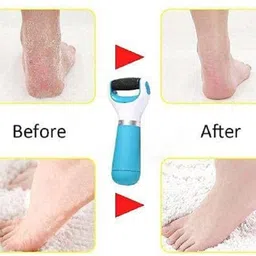 evererin Rechargeable Foot Callus and Dead Skin Removal, Pedicure Kit for Feet Care image 2