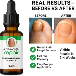 vivaglo Professional Nail Repair Serum Helps strengthen breaking nails malticolur Men & Women-picture-28