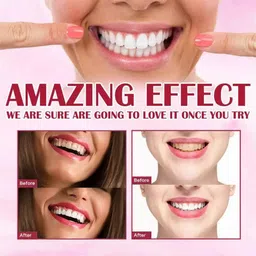 sonavi Teeth Foam Advanced Cleansing and Stain Removal Teeth Whitening Kit image 4