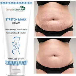 Stretch Marks Removal Cream for Women Men 100% Natural Ayurvedic Cream Intimate Cream-image-65