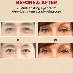 maree SEOUL 1988 Under Eye Cream – Revives Dull, Tired & Puffy Eyes image 5