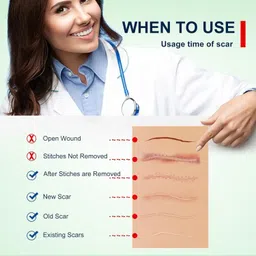 dardris Silicone Scar Sheet Tape Roll scar removal for C-Section, Surgical Scars, Keloid Hydrocolloid Medical Dressing image 3