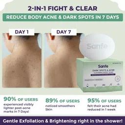 sanfe Dark Spots & Acne Clearing Body Soap Salicylic Acid (Pack of 3) image 2