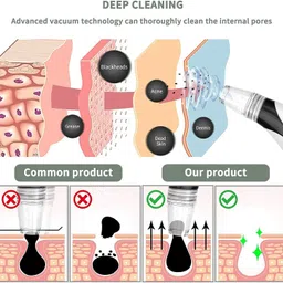 clothydeal Plastic Blackhead Remover Vacuum Suction Device image 3