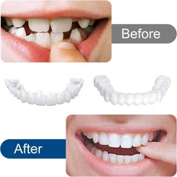 layyin mart Teeth Teeth Comfort Fit Whitening Veneer Snap on Teeth Wipe image 3