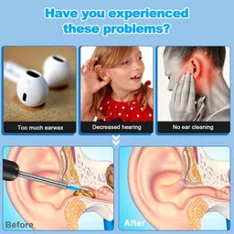 wannasky Ear Wax Remover Tool Kit with Ear Curette Cleaner and Spring Ear Buds Cleaner image 5