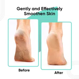 rikheeya Natural Pumice Stone for Feet, Pedicure Tools Hard Skin Callus Remover for Feet image 4