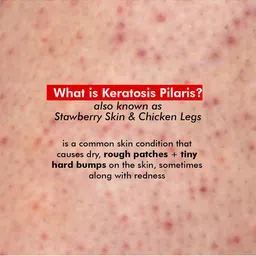 Conscious Chemist Bumps Escape Body Exfoliating & Pigment Corrector Body Lotion 100gm image 3