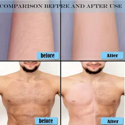 utmhub Women and Men Nano-crystalline Technology-Painless,Reusable Hair Eraser Stone, Men & Women image 5