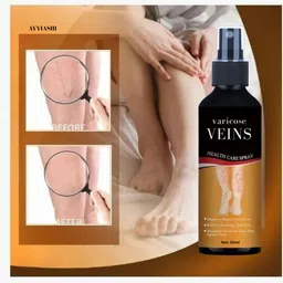 ayyiashi Varicose Veins Relief Spray Easy To Use Everyday Liquid image 2