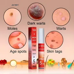 Avibbo Tags And Moles Remover | For Clear Skin Deep Action Care image 3