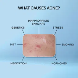 DermDoc Kojic Acid Night Cream 50g – Face Whitening Solution image 4