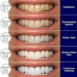 ophyra Original Portable Advanced Professional Teeth Whitening Strips Teeth Whitening Kit image 5