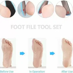 feelhigh Foot File, Dead Hard Skin Callus Remover, Portable Scraper Pedicure Kit image 2