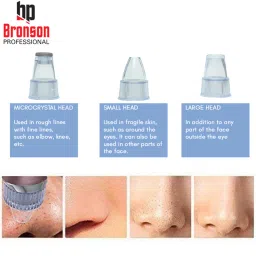 Bronson Professional Pore Cleanser Blackhead Dermasuction Remover Battery Operated With 4 Nozzles image 3