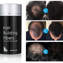 myn Professional Hair Fibers for Thinning Hair, Hair Thickener Easy to Use Gentle Plant Formula Hypoallergenic Natural Look-Effect in 5 Seconds Lasts All Day Hair Building Fibers for Men & Women (Black) image 5